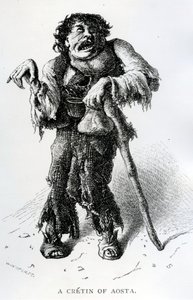 A Crétin z Aosty, kolem roku 1870 (dřevoryt)